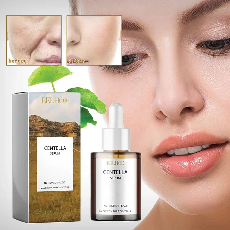 Sérum Centella Asiática — Calmante, Hidratante e Iluminador